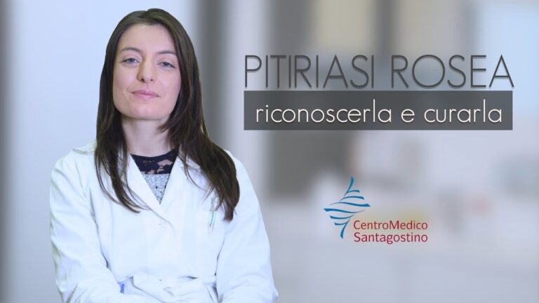 La tigna sta guarendo? Scopri i segnali per saperlo!