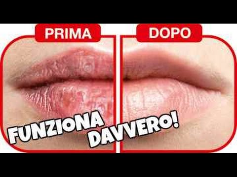 Risveglia le tue labbra: come evitare il fastidio delle labbra che si spellano