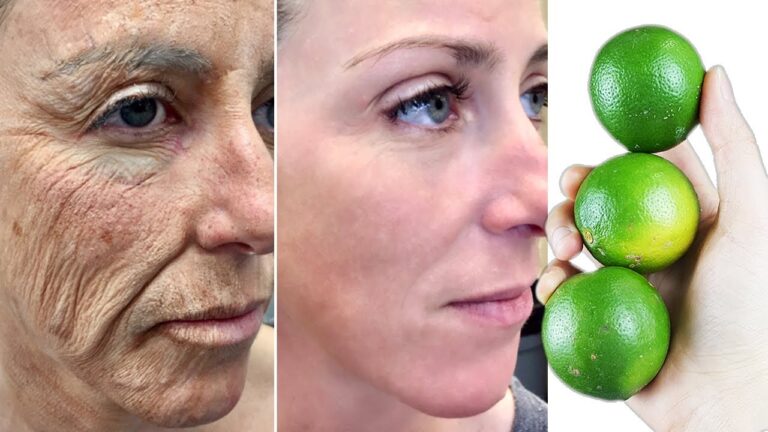 I miracoli del limone sul viso: il rimedio antirughe che funziona!