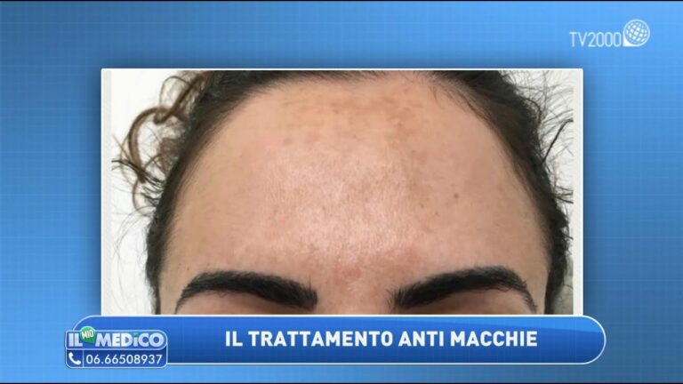 Le macchie in faccia marroni: il segreto per una pelle impeccabile in pochi passi!