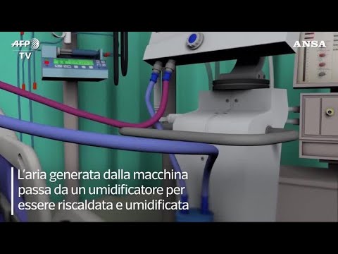 Ventilazione IVA: scopri come ottimizzare i tuoi costi aziendali