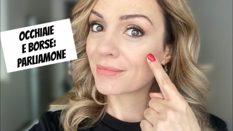 Bye bye occhiaie: scopri il rimedio segreto in 5 passi!