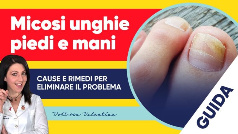 Unghie impeccabili: scopri come eliminare il fastidioso puntino bianco!