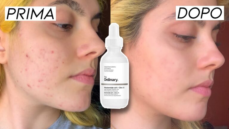 The Ordinary: Un Trasformazione Straordinaria Prima e Dopo