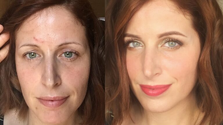 Brufolo rosso? Ecco come coprirlo e sconfiggerlo!