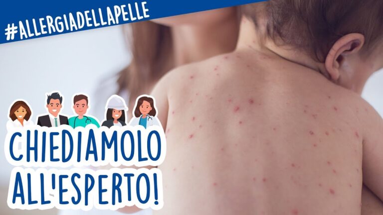 Orticaria post infettiva: cosa fare per i bambini?